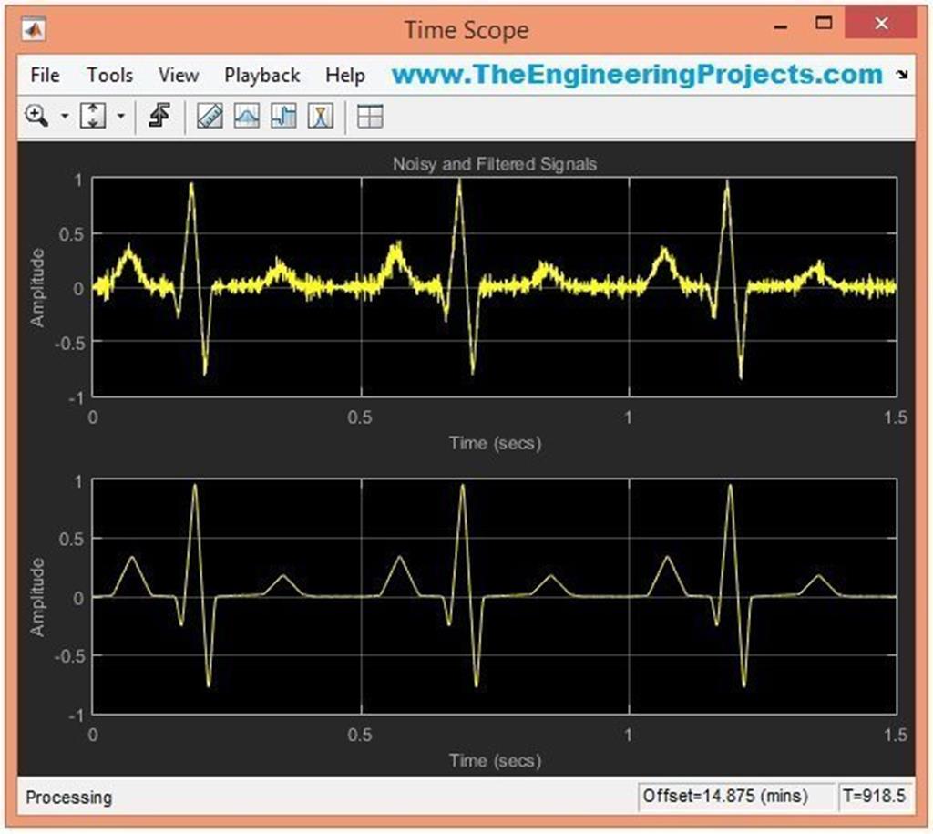 Ecg Simulation Using Matlab - The Engineering Projects