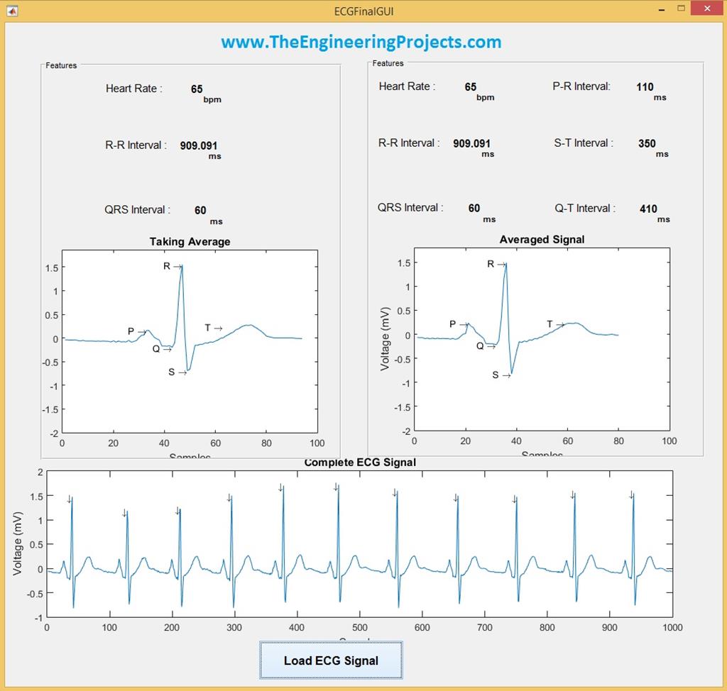 ECG Averaging In MATLAB - The Engineering Projects