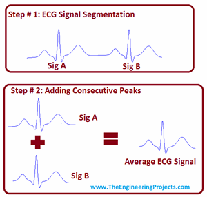 ECG Averaging in MATLAB - The Engineering Projects