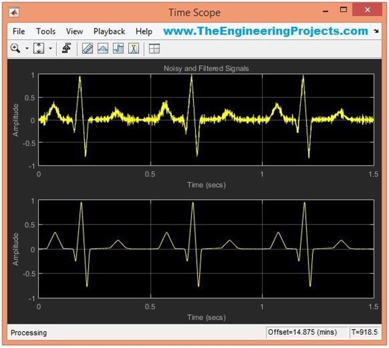 ECG Simulation Using MATLAB - The Engineering Projects