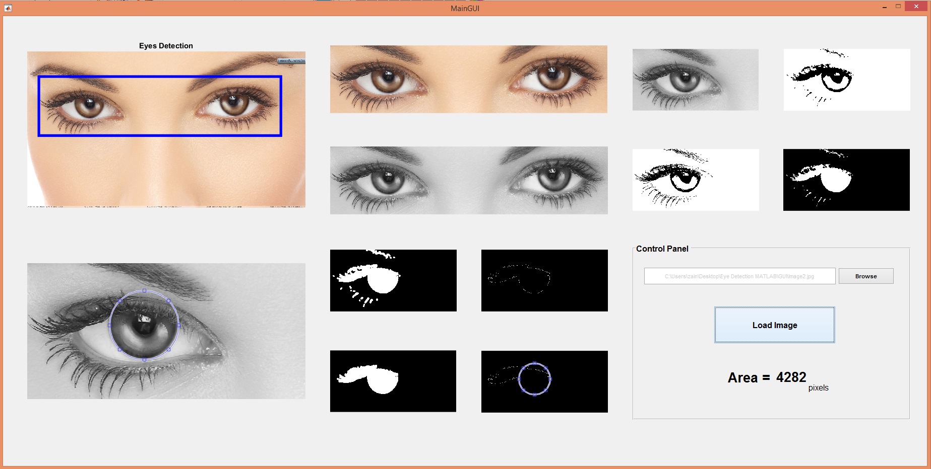 eye ball detection, detect eye ball matlab, eye ball detection in matlab, matlab eye ball detection, eye ball matlab, eye detection