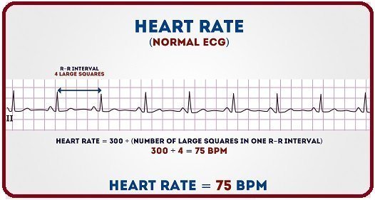 Introduction to ECG, basics of ECG, ECG basics, what is ECG, disease detected through ECG, diseases detected via ECG, when to do ECG, ECG introduction, ECG, know about ECG, how to know about ECG