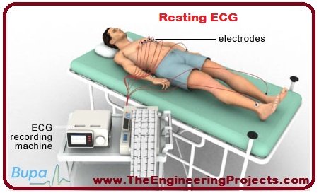 Introduction to ECG, basics of ECG, ECG basics, what is ECG, disease detected through ECG, diseases detected via ECG, when to do ECG, ECG introduction, ECG, know about ECG, how to know about ECG