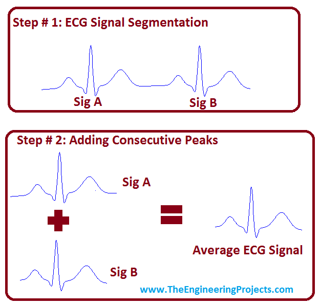 ECG Averaging in MATLAB, ECG Average,average ecg,ecg averaging