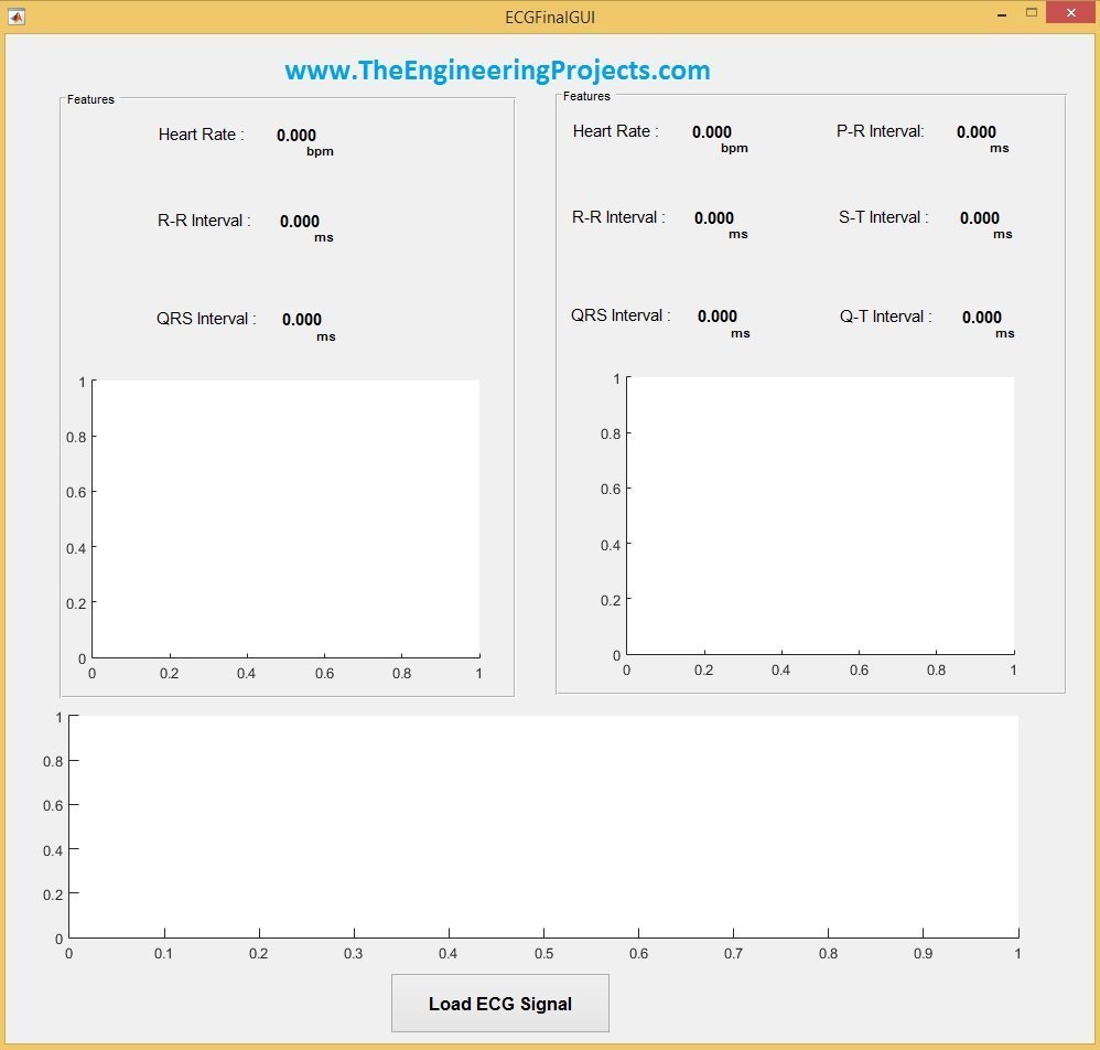 ECG Averaging in MATLAB, ECG Average,average ecg,ecg averaging