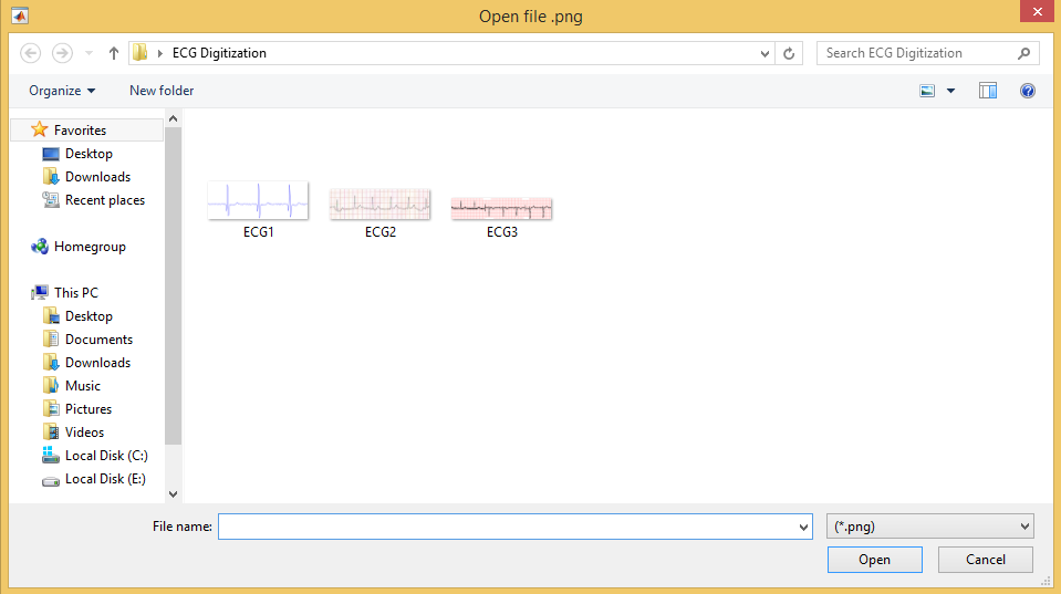 ECG Digitization in MATLAB,ECG Digitization,ECG Digitization MATLAB, digitization of ecg signals