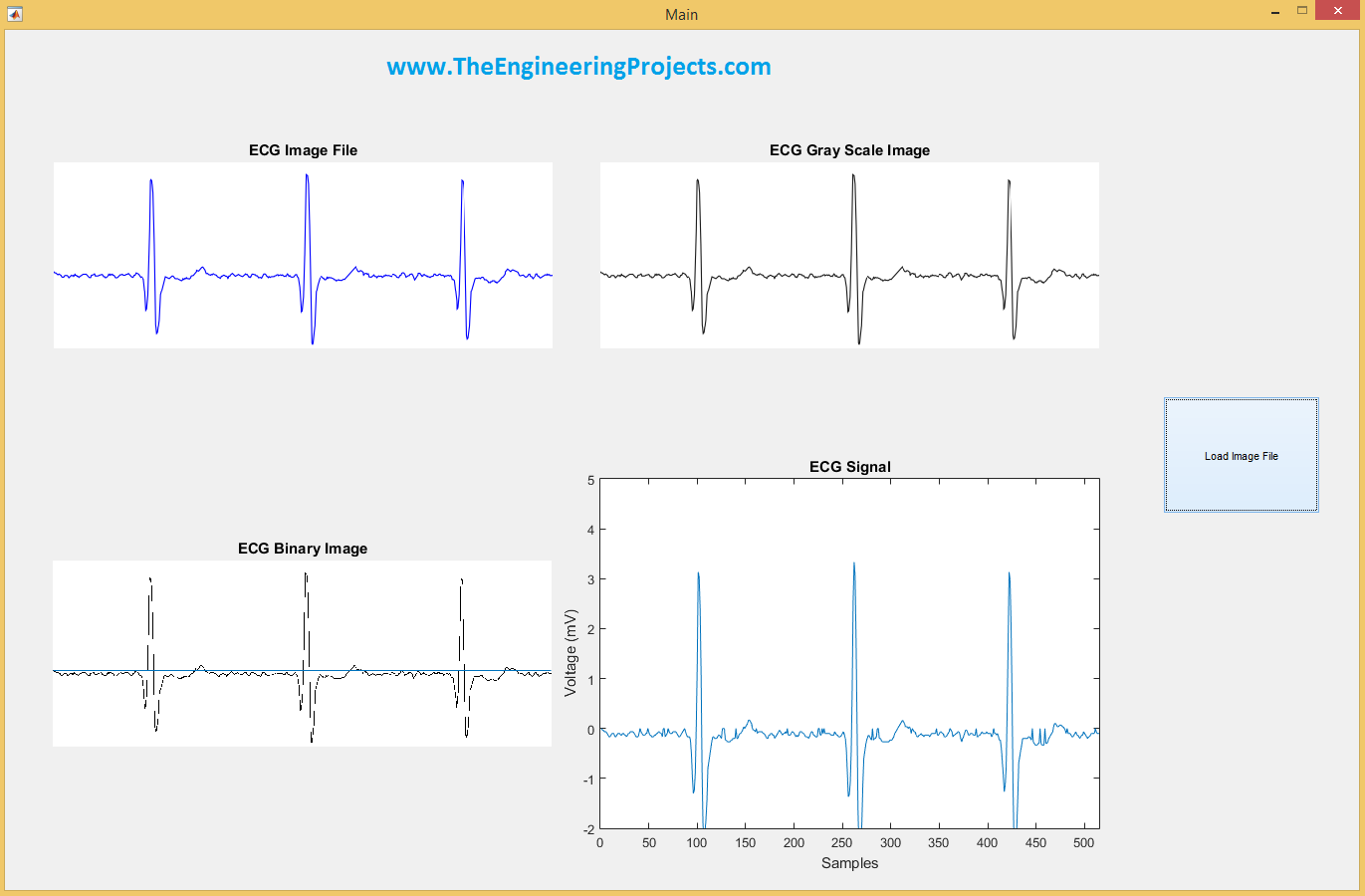 ECG Digitization in MATLAB,ECG Digitization,ECG Digitization MATLAB, digitization of ecg signals