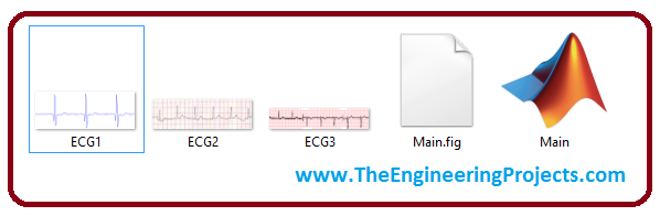 ECG Digitization in MATLAB,ECG Digitization,ECG Digitization MATLAB, digitization of ecg signals